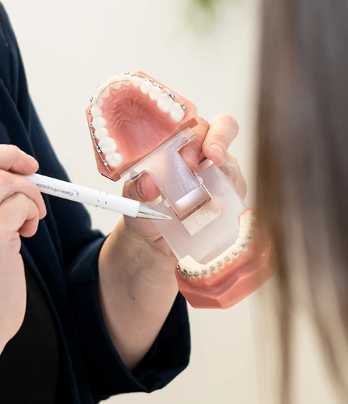 Modell einer festen Zahnspange mit Metallbrackets
